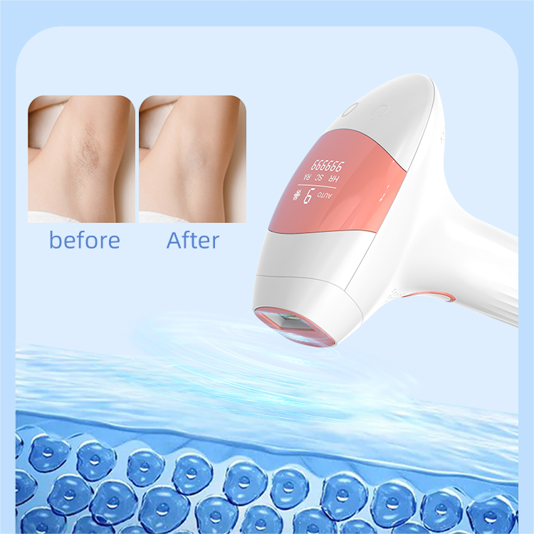 IceGlow Pro™ IPL Hair Removal Device